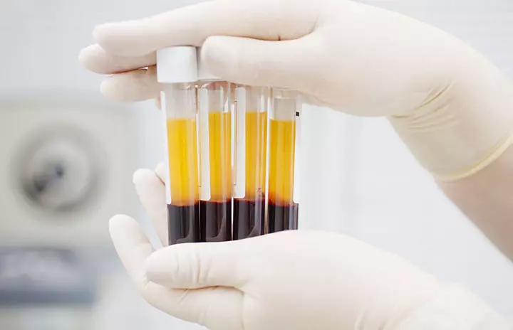 PRP Centrifuge – A Game Changer In Pain Management 9 PRP Centrifuge