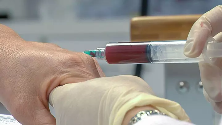 PRP Centrifuge – A Game Changer In Pain Management 5 PRP Centrifuge