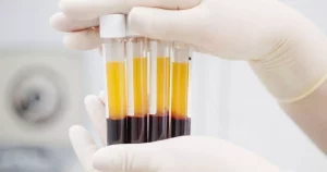 Campaign Ads 9 PRP Centrifuge