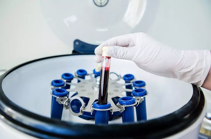 PRP Centrifuge – A Game Changer In Pain Management 8 PRP Centrifuge