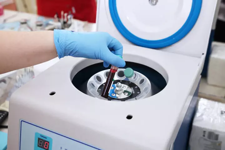 PRP Centrifuge – A Game Changer In Pain Management 3 PRP Centrifuge