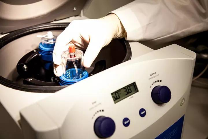 PRP Centrifuge – A Game Changer In Pain Management 4 PRP Centrifuge