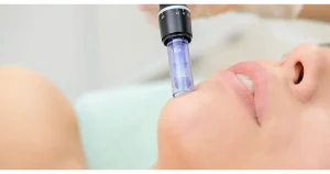 Campaign Ads 5 Hyaluron Pen Treatment