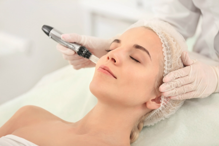 Get Glowing Skin With No Effort With Best Dermapen 2 best dermapen