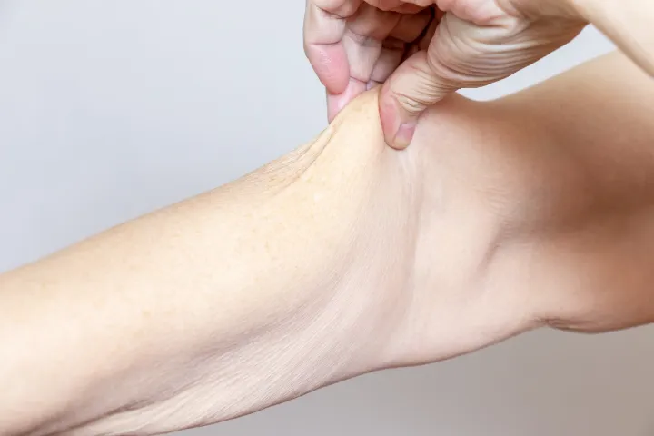 How To Fix Crepey Skin 2 fix crepey skin