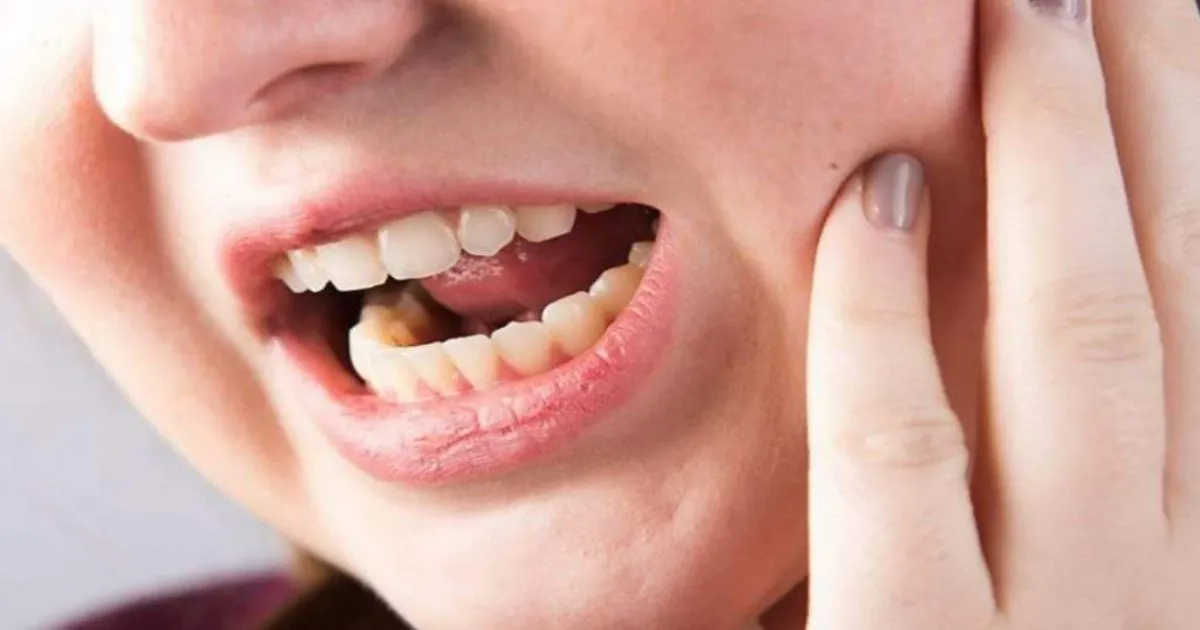 How To Fix Lockjaw On Your Own 1 how to fix lockjaw on your own