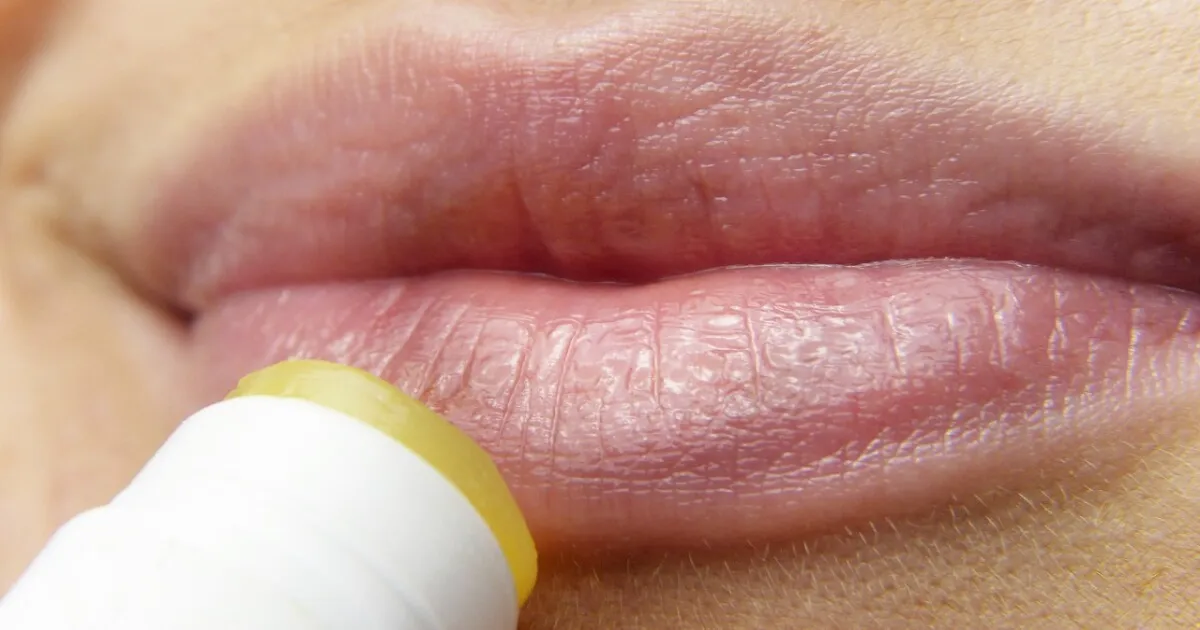 fix chapped lips