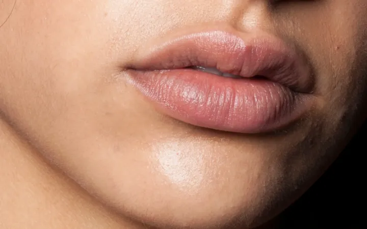 How To Fix Chapped Lips 6 fix chapped lips